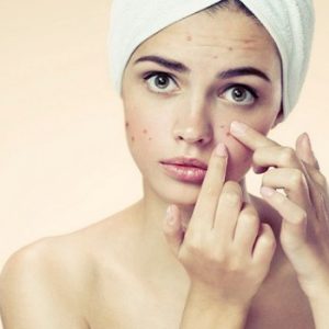 acne, pelle, image